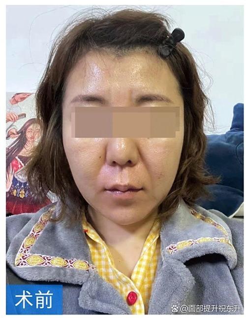 新氧整形2026最新
