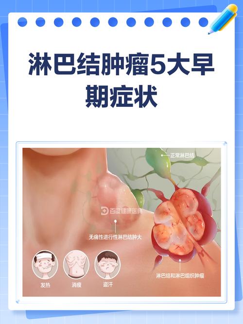 淋巴瘤之家2026最新
